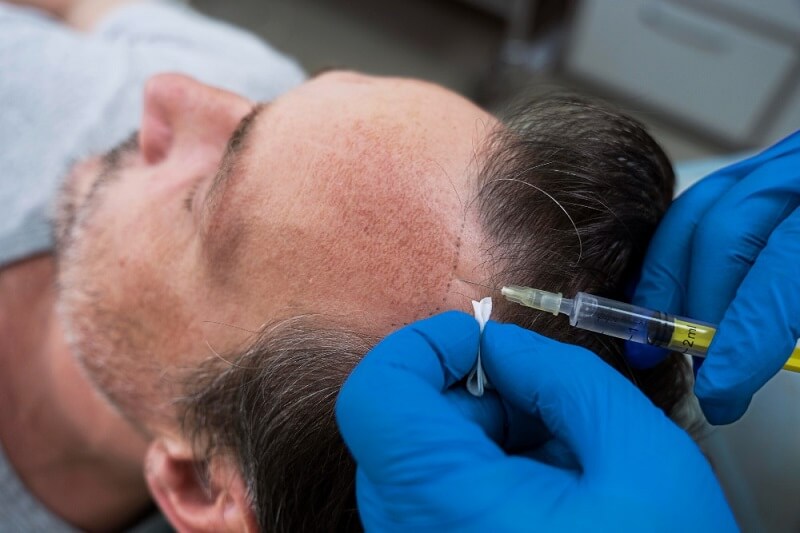PRP Injections 