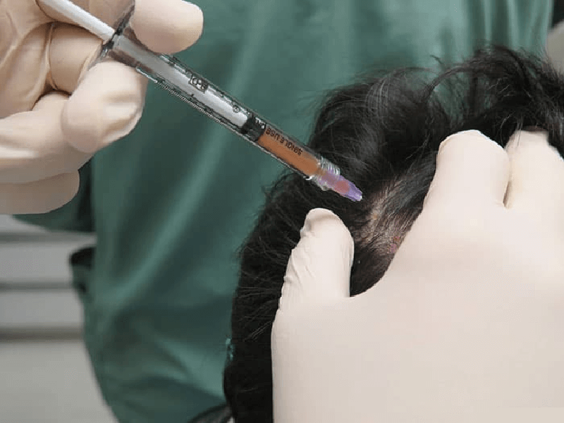 PRP Injections 