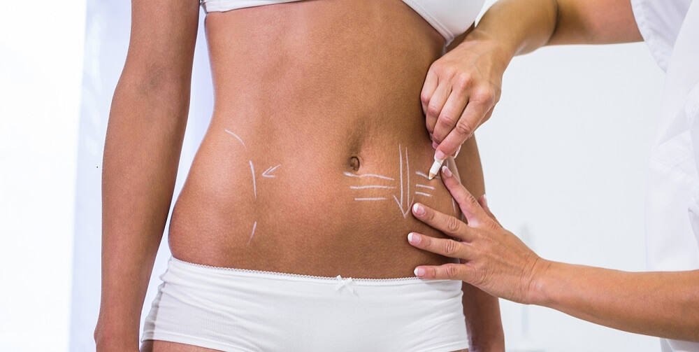 Post-Pregnancy Contouring